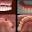NewMe Dental Implant Specialist Icon